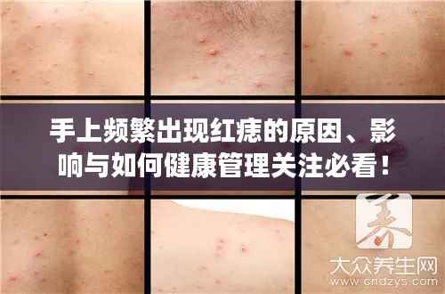 手上频繁出现红痣的原因、影响与如何健康管理关注必看！